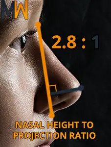 nasal projection