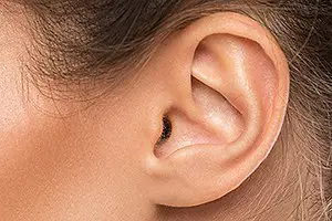 Ear Aesthetics [The Ultimate Guide]